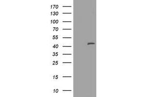 Image no. 1 for anti-Melanoma Antigen Family A, 3 (MAGEA3) antibody (ABIN1499254) (MAGEA3 Antikörper)