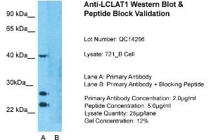 Host: Rabbit  Target Name: LCLAT1  Sample Tissue: Human 721_B cell  Lane A:  Primary Antibody Lane B:  Primary Antibody + Blocking Peptide Primary Antibody Concentration: 1 µg/mL Peptide Concentration: 5. (LCLAT1 Antikörper  (Middle Region))