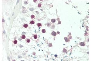 Immunohistochemistry (Paraffin-embedded Sections) (IHC (p)) image for anti-Jumonji C Domain-Containing Histone Demethylase 1 Homolog D (JHDM1D) (AA 290-316) antibody (ABIN651309)