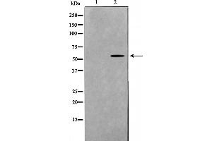 Western blot analysis on mouse brain cell lysate using DOK7 Antibody，The lane on the left is treated with the antigen-specific peptide. (DOK7 Antikörper  (C-Term))