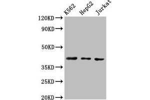 Western Blot Positive WB detected in: K562 whole cell lysate, HepG2 whole cell lysate, Jurkat whole cell lysate All lanes: CXCR3 antibody at 3 μg/mL Secondary Goat polyclonal to rabbit IgG at 1/50000 dilution Predicted band size: 41, 46, 29 kDa Observed band size: 41 kDa (CXCR3 Antikörper  (AA 4-50))