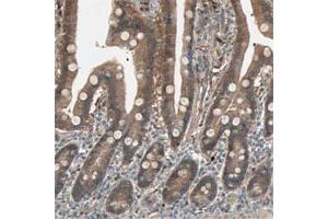 Immunohistochemical staining of human duodenum shows moderate cytoplasmic positivity in glandular cells. (SDSL Antikörper)