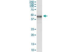 MAGEC2 MaxPab polyclonal antibody. (MAGEC2 Antikörper  (AA 1-373))