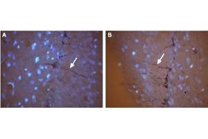 Expression of CNG3 in rat brain - Immunohistochemical staining of frozen rat hippocampal dentate gyrus (DG) sections using Anti-CNGA3 Antibody (ABIN7043091 and ABIN7044975). (CNGA3 Antikörper  (Intracellular))