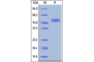 SDS-PAGE (SDS) image for Inducible T-Cell Co-Stimulator (ICOS) (AA 21-141) (Active) protein (Fc Tag) (ABIN6809913)