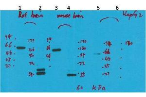 Western Blot (WB) analysis of 1) Rat Brain Tissue-Low Molecular Protein Marker, 2)Rat Brain Tissue-High Molecular Protein Marker, 3) Mouse Brain Tissue-Low Molecular Protein Marker, 4) Mouse Brain Tissue- High Molecular Protein Marker, 5) HepG2-Low Molecular P. (KCNH5 Antikörper)