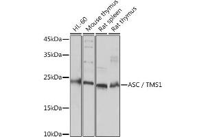 Western blot analysis of extracts of various cell lines, using ASC/TMS1 Rabbit pAb (ABIN7269756) at 1:3000 dilution. (PYCARD Antikörper)