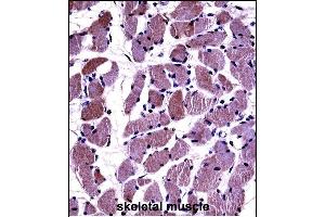 DAG1 Antibody (C-term) ((ABIN658022 and ABIN2846960))immunohistochemistry analysis in formalin fixed and paraffin embedded human skeletal muscle followed by peroxidase conjugation of the secondary antibody and DAB staining. (Dystroglycan Antikörper  (C-Term))