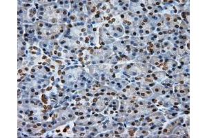 Immunohistochemical staining of paraffin-embedded Kidney tissue using anti-DAPK2 mouse monoclonal antibody. (DAPK2 Antikörper)