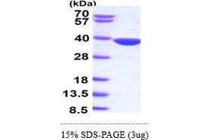 SDS-PAGE (SDS) image for Aldo-Keto Reductase Family 1, Member B10 (Aldose Reductase) (AKR1B10) (AA 1-316) protein (ABIN667103)