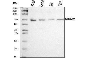 Western blot analysis of TOMM70 using anti-TOMM70 antibody (ABIN7599855).