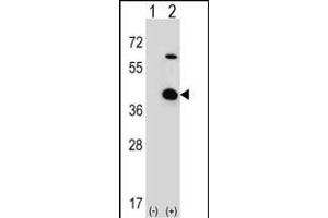Western blot analysis of STR (arrow) using rabbit polyclonal STR Antibody (C-term) 2933b. (STRAP Antikörper  (C-Term))