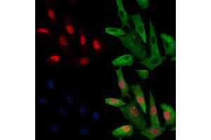 ABIN6256313 and ABIN6267679 staining  cells(H2O2 treatment) by IF/ICC. (HDAC2 Antikörper  (pSer394))