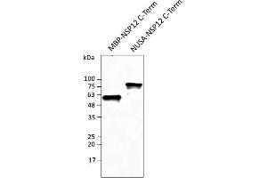Western Blotting (WB) image for anti-SARS-CoV-2 RNA-dependent RNA Polymerase (NSP12) (SARS-CoV-2 RdRP) (C-Term) antibody (ABIN7273004) (SARS-CoV-2 NSP12 (RdRP) Antikörper  (C-Term))