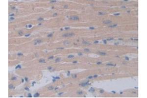 IHC-P analysis of Mouse Heart Tissue, with DAB staining. (Occludin Antikörper  (AA 17-107))