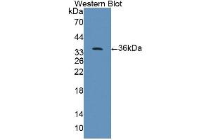 Figure. (PPFIA1 Antikörper  (AA 1-250))
