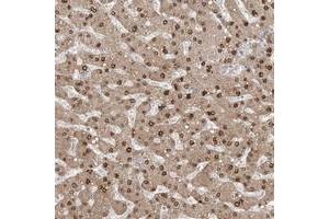 Immunohistochemical staining of human liver with AOF1 polyclonal antibody  shows nuclear and cytoplasmic positivity in hepatocytes. (KDM1B Antikörper)