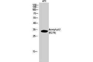 Western Blotting (WB) image for anti-P57 (acLys278) antibody (ABIN3181900) (P57 (acLys278) Antikörper)