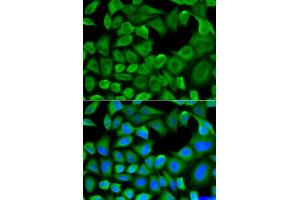 Immunofluorescence analysis of HeLa cells using BCL2L11 antibody. (BIM Antikörper)