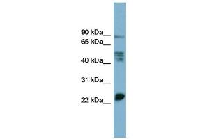 WB Suggested Anti-MPZL1 Antibody Titration:  0. (MPZL1 Antikörper  (Middle Region))