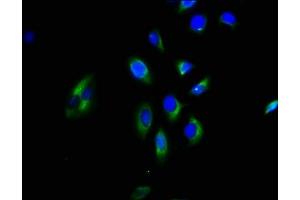 Immunofluorescence staining of A549 cells with ABIN7154684 at 1:200, counter-stained with DAPI. (GNGT2 Antikörper  (AA 1-66))