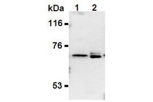 Western Blotting (WB) image for anti-Synaptotagmin II (SYT2) (AA 1-20), (N-Term) antibody (ABIN1449191) (SYT2 Antikörper  (N-Term))