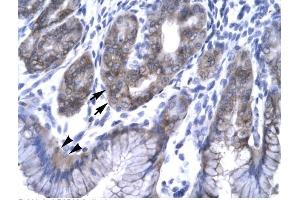 Human Stomach; Rabbit Anti-EAP30 Antibody. (SNF8 Antikörper  (N-Term))