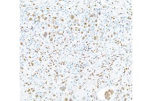 Immunohistochemistry (IHC) image for anti-RNA Binding Motif Protein 9 (RBM9) (AA 1-50) antibody (ABIN7454009)