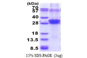 RNF114 Protein (AA 1-228) (His tag)