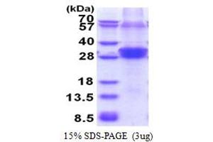 SDS-PAGE (SDS) image for Ring Finger Protein 114 (RNF114) (AA 1-228) protein (His tag) (ABIN5853600)