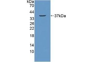 Detection of Recombinant NUP214, Mouse using Polyclonal Antibody to Nucleoporin 214 kDa (NUP214) (NUP214 Antikörper  (AA 601-868))