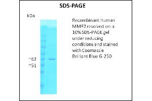 SDS-PAGE (SDS) image for Matrix Metalloproteinase 2 (MMP2) (Active) protein (ABIN5509491) (MMP2 Protein)