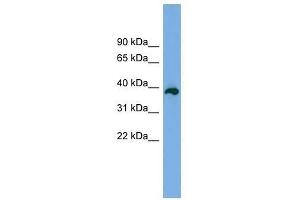 Western Blot showing DEDD2 antibody used at a concentration of 1-2 ug/ml to detect its target protein. (DEDD2 Antikörper  (Middle Region))