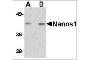 Western blot analysis of Nanos1 in rat brain tissue lysate with this product at (A) 1 and (B) 2 μg/ml. (Nanos Homolog 1 Antikörper  (Center))