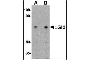 Western blot analysis of LGI2 in 293 cell lysate with this product at (A) 1 and (B) 2 μg/ml. (LGI2 Antikörper  (N-Term))