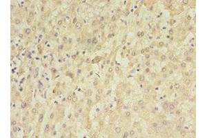 Immunohistochemistry of paraffin-embedded human liver tissue using ABIN7159638 at dilution of 1:100 (TET3 Antikörper  (AA 72-335))