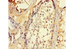 Immunohistochemistry of paraffin-embedded human testis tissue using ABIN7145717 at dilution of 1:100 (SLC25A14 Antikörper  (AA 55-111))