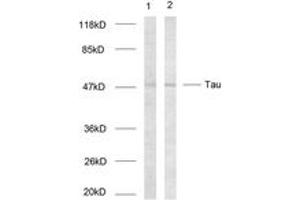 Western blot analysis of extracts from HeLa cells, using Tau (Ab-214) Antibody. (tau Antikörper  (AA 501-550))