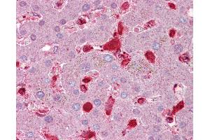 Anti-Antithrombin III antibody IHC of human liver. (SERPINC1 Antikörper  (AA 143-192))