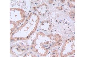 IHC-P analysis of Kidney tissue, with DAB staining. (PTBP1 Antikörper  (AA 1-531))