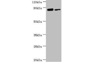 Western blot All lanes: TFIIH basal transcription factor complex helicase XPD subunit antibody at 2 μg/mL Lane 1: 293T whole cell lysate Lane 2: K562 whole cell lysate Secondary Goat polyclonal to rabbit IgG at 1/10000 dilution Predicted band size: 87, 47 kDa Observed band size: 87 kDa (ERCC2 Antikörper  (AA 1-300))