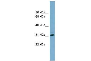 RNF144B antibody used at 1 ug/ml to detect target protein. (RNF144B Antikörper  (Middle Region))