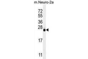 Western Blotting (WB) image for anti-Lin-28 Homolog A (C. Elegans) (LIN28A) antibody (ABIN2996249)