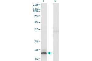 Western Blot analysis of IFNA13 expression in transfected 293T cell line by IFNA13 monoclonal antibody (M03), clone 3F9. (IFNA13 Antikörper  (AA 91-189))