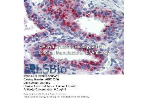 Immunohistochemistry (IHC) image for anti-Potassium Channel, Subfamily K, Member 9 (KCNK9) (N-Term) antibody (ABIN404986) (KCNK9 Antikörper  (N-Term))