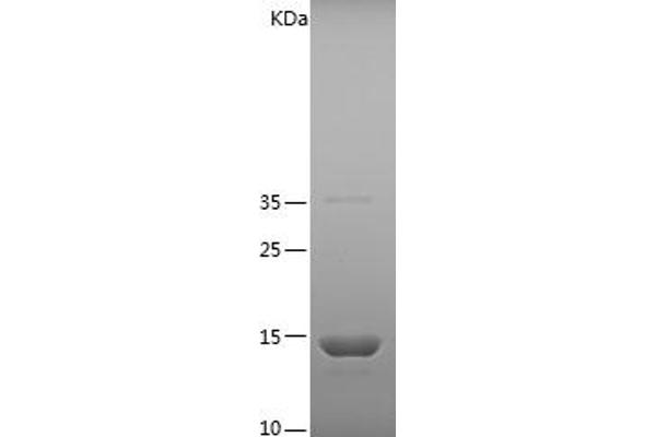 FABP2 Protein (AA 2-132) (His tag)