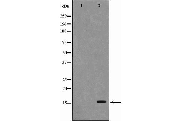 PFDN1 Antikörper  (Internal Region)