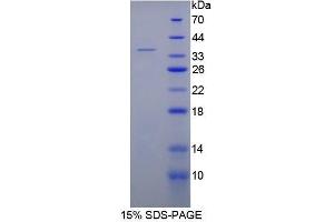 SDS-PAGE (SDS) image for Complement Component 5a (C5a) (AA 12-64) protein (His tag,GST tag) (ABIN1879979) (C5A Protein (AA 12-64) (His tag,GST tag))