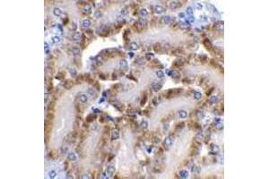 Immunohistochemistry of CAD in mouse kidney tissue with CAD antibody at 2 μg/ml. (DFFB Antikörper)