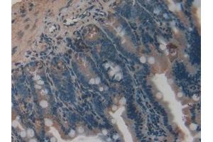 Immunohistochemistry (IHC) image for anti-Vascular Endothelial Growth Factor C (VEGFC) (AA 108-223) antibody (ABIN7429439)